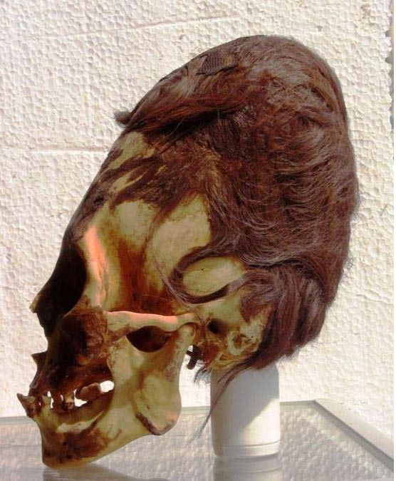 Paracas skull with its red hair Nuevas pruebas de ADN en cráneos alargados de Paracas de 2.000 años de antigüedad cambian la historia conocida