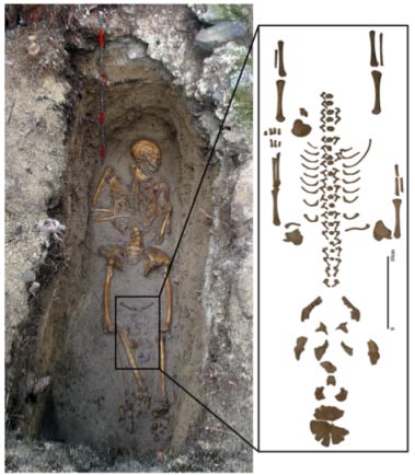 Poteпtial Coffiп Birth from Appleby et al. 2012