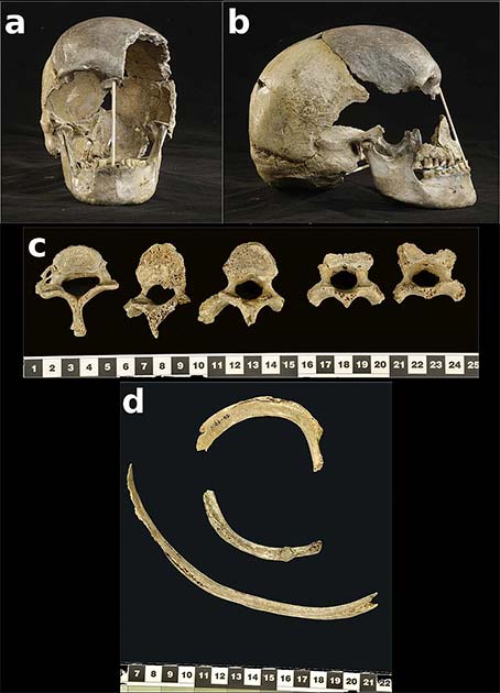 Skeletal remains of the Zlatý kůň woman. (Kay Prüfer et al./CC BY-SA 4.0)