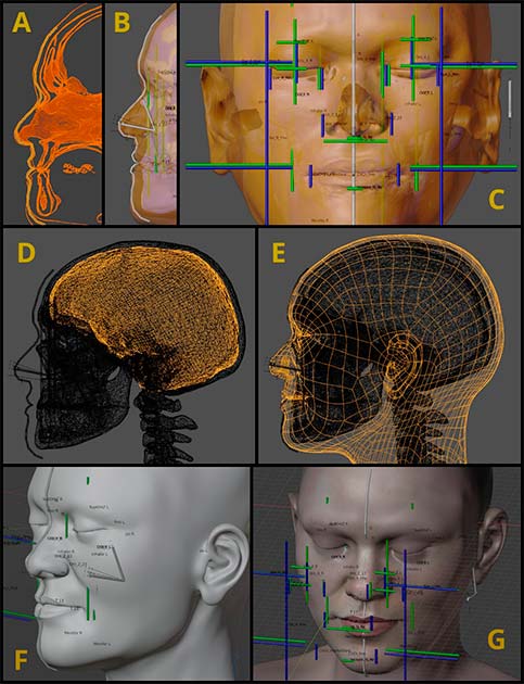 Stages of forensic facial approximation. (Cicero Moraes et al.)