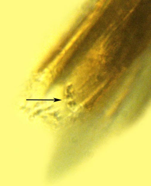 The bacteria on the flea trapped in amber