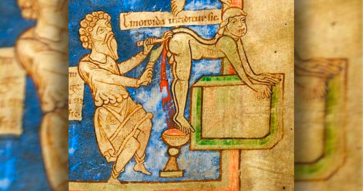 Hippocrates Did What To Treat Hemorrhoids Ancient Origins