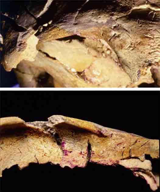 The right orbital margin of the male found in Tomb II, showcasing the frontal and internal views. It's important to observe the absence of any injuries. (Public Domain)