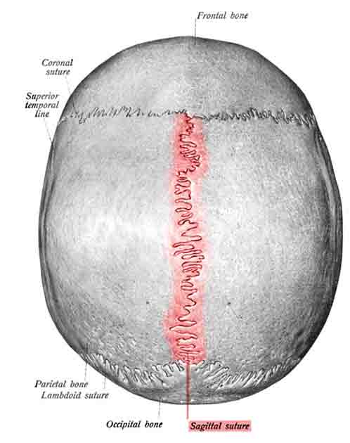 The sagittal suture, highlighted in red, separates the two parietal plates (Public Domain)