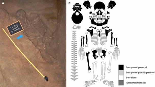 Left; Adult female skeleton (SG.14-SK.7) in situ (Photograph by ©Joana Garcia/Município de Constância). Right; Schematic bone inventory of individual SG.14-SK.7. The visual recording form was adapted from Roksandic (2003). (Assis, Sandra et al./ International Journal of Paleopathology)