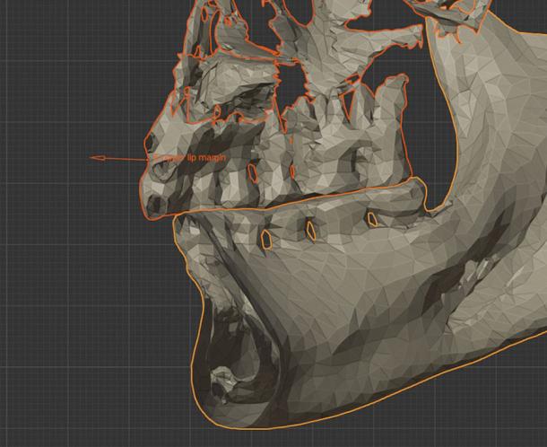 Diagram showing the reconstruction of the soft tissues of the Swiss mummy using anatomical measuring points and empirical mean values determined from forensic studies. (FAPAB Research Center / Cicero Moraes)