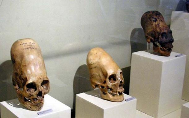 Example of the Paracas elongated skulls. (Public Domain)