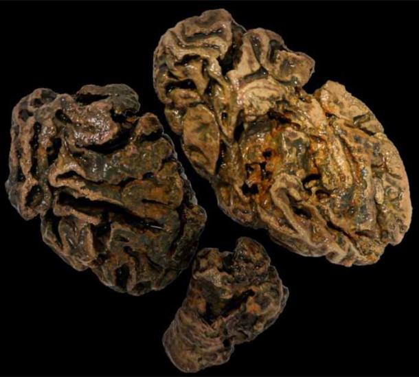 Fragments of a brain from an individual buried in a waterlogged Victorian workhouse cemetery (UK), some 200 years ago were the only soft tissue not totally dissolved. (Alexandra L. Morton-Hayward/Royal Society Publishing)