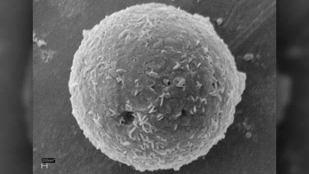 Interior analysis of the Neolithic fisherman's bones revealed traces of microscopic sea life, such as parasite eggs and algae. This image shows a degraded unicellular green alga that lives in marine ecosystems. (Stephen Bates / Andrade et al.)