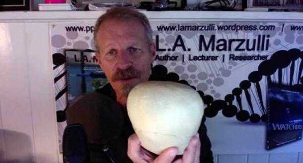 LA Marzulli shows the top of one of the Paracas skulls, which has no sagittal suture.