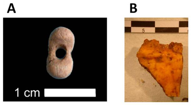 (A) Mammoth ivory pierced bead discovered in the layer of (B) bone fragment analyzed in the current study. (L. Crépin/E.-M. Geigl, provided by the author/The Conversation)