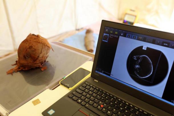 Radiological analysis of the head of a mummified child from the west Aswan Greco-Roman tomb, performed with a portable X-ray machine. (Egyptian-Italian Mission (EIMAWA))