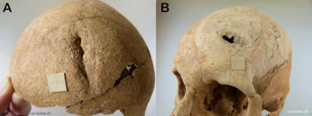 Skulls from Las Gobas showing evidence of violence. (Lourdes Herrasti, Author provided,no reuse)