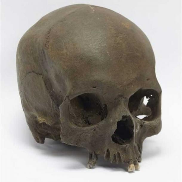 The woman's skull was deliberately severed from her body.