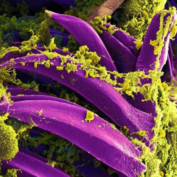 Scanning electron micrograph of Yersinia pestis, which causes bubonic plague, on a flea