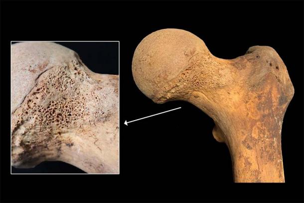 A femur, one of the bones that held traces of cannabis (Gaia Giordano, Mirko Mattia, Michele Boracchi, et al. / Science Direct)