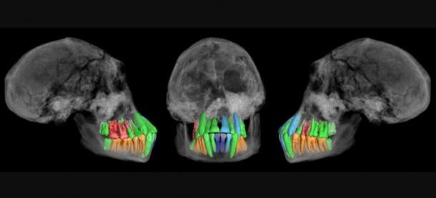 Skull and dentition of a young individual of early Homo from Dmanisi