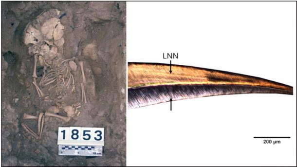 Left, Burial of a perinatal individual from the Fortalesa dels Vilars, Right, baby's central incisor 