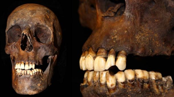 Skull and jaw from the remains used in the study.