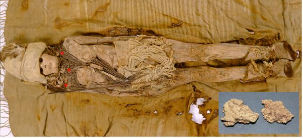 A photo of one of the mummies from the Xiaohe cemetery, with the kefir samples (highlighted with red triangles) scattered around the neck of the mummy