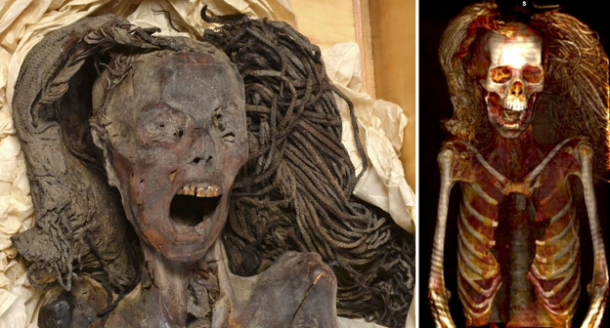 Left; The Screaming Woman mummy, Right; CT scan of the Screaming Woman mummy, wearing her wig.
