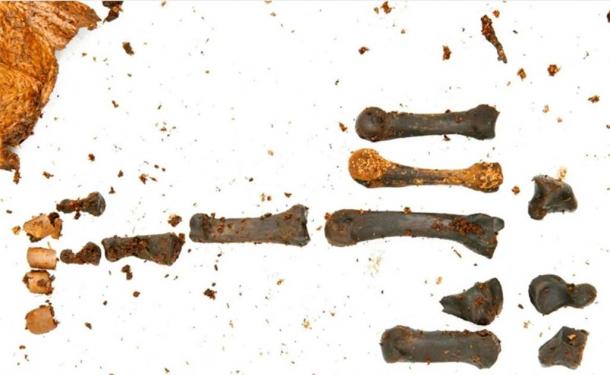 Image of left hand bones of the bog body found in Bellaghy, Northern Ireland. (PSNI)