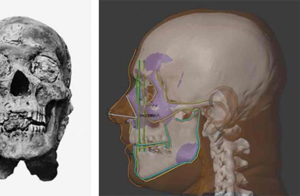 Left; Mummified head of Amenhotep III following unwrapping. Right; Moraes used the skull and data from living donors to reconstruct the facial features of Amenhotep III (Left; Public Domain, Right; Cicero Moraes)