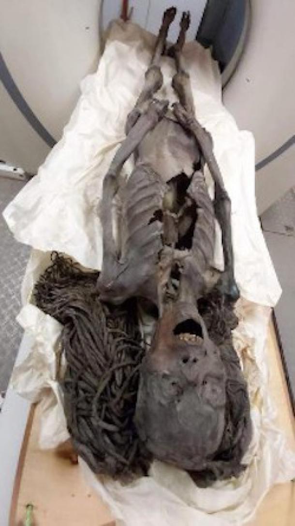 'Screaming Woman' Mummy May Have Died in Agony 3,500 Years Ago