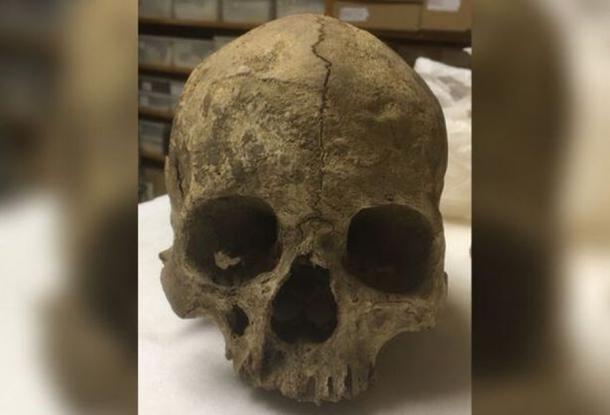 The haunting empty eye sockets of Greta’s skull are silent, but carbon dating has proven her to be a medieval woman who was likely decapitated. (David Adkins / StaffordshireLive)